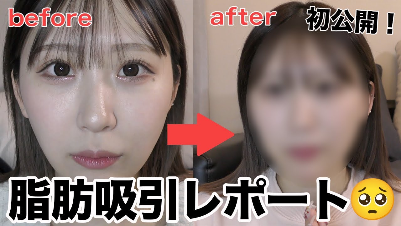 トリガー、sns