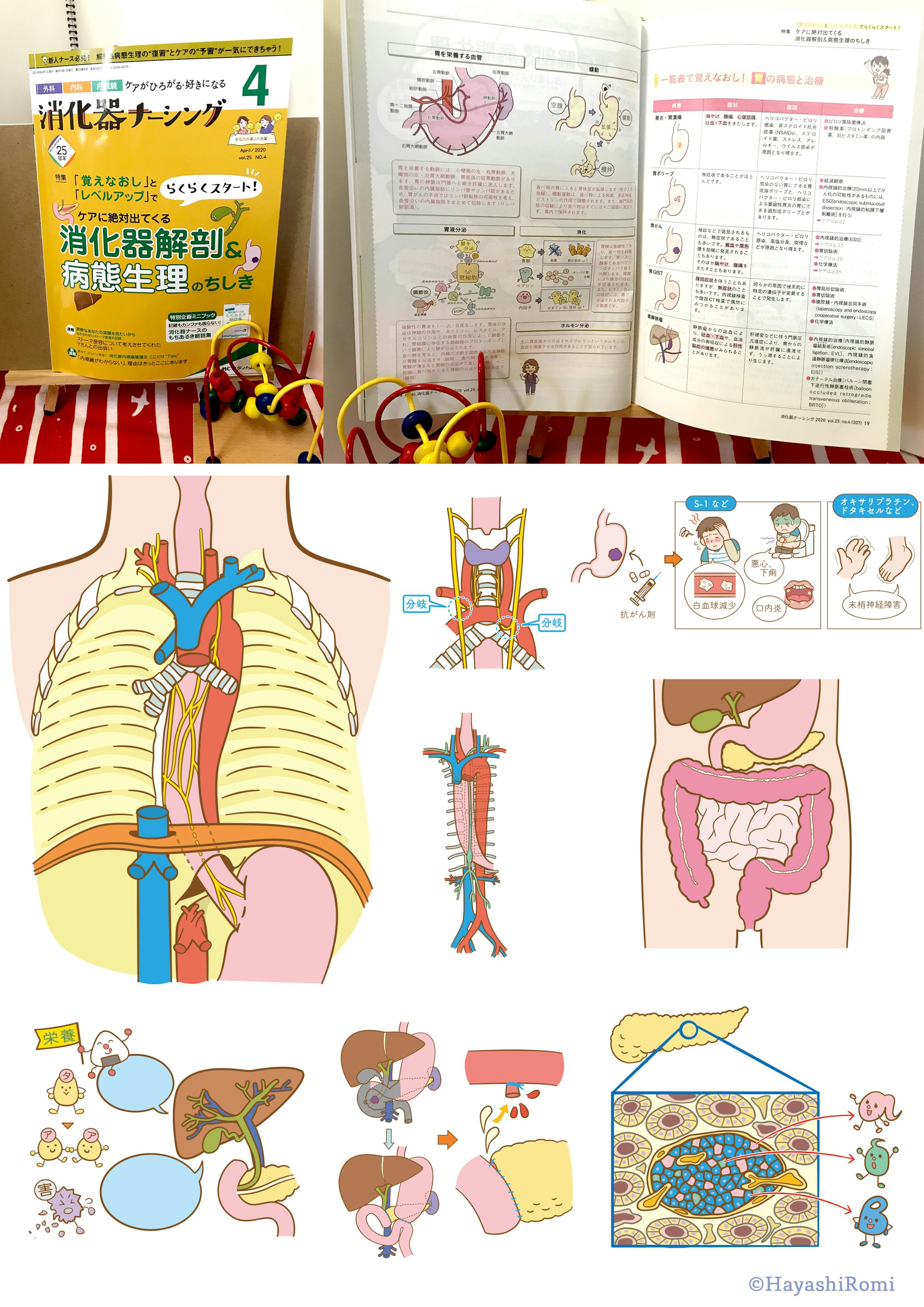 年 消化器ナーシング4月号 特集消化器解剖 病理整体のちしき イラスト担当