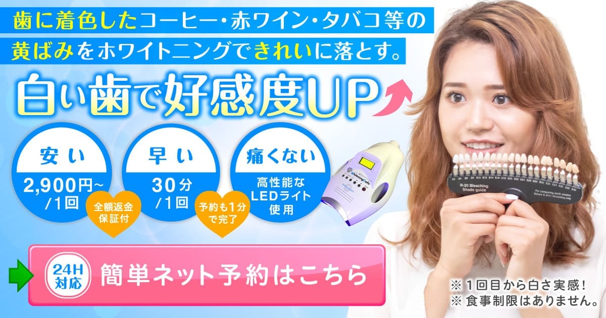 安い・早い・痛くない！歯のホワイトニングWhiteningCafe