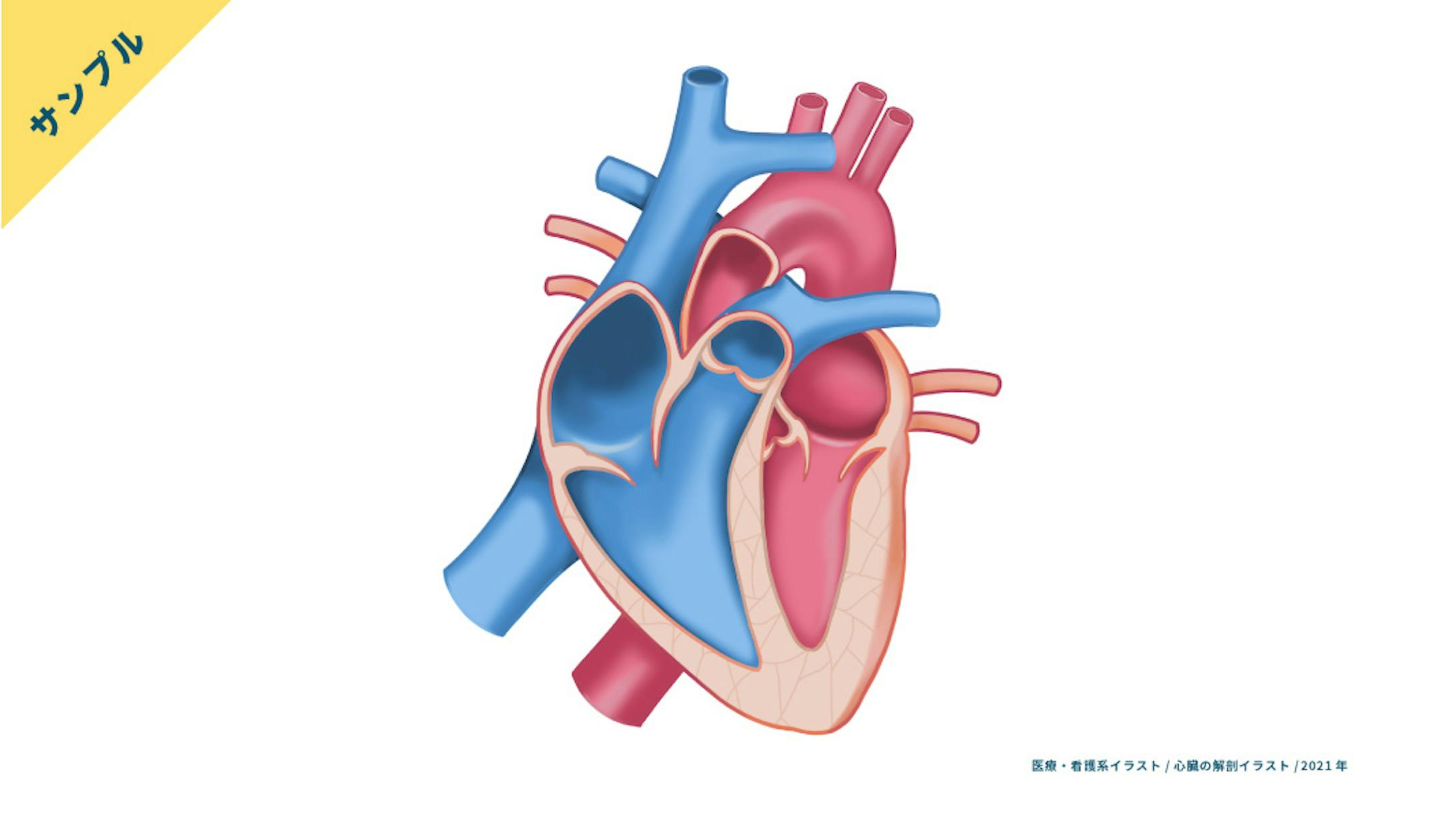 サンプル 心臓