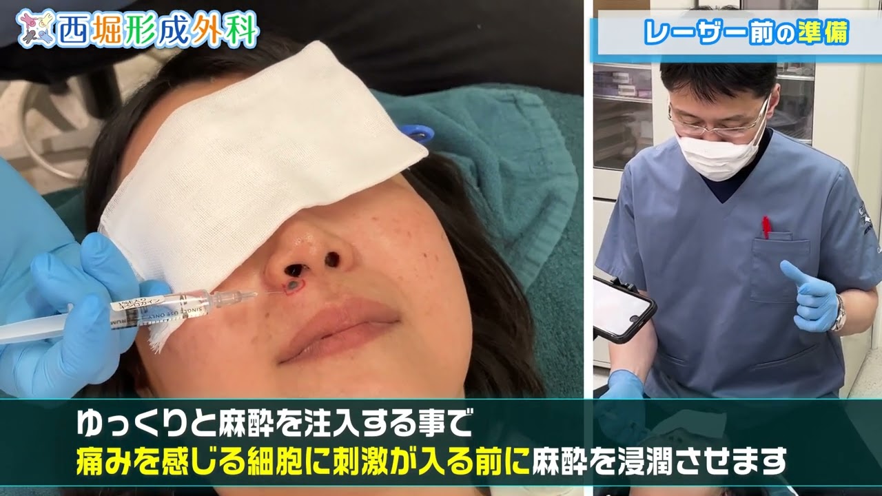 サムネ、巨乳