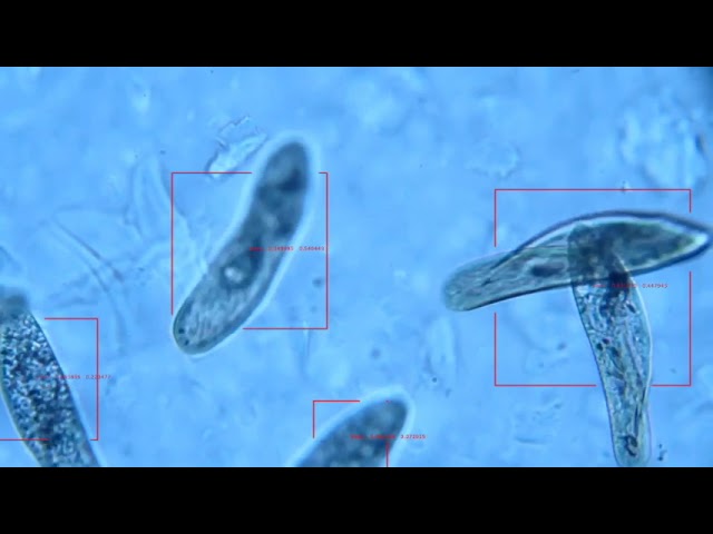ゾウリムシ detection
