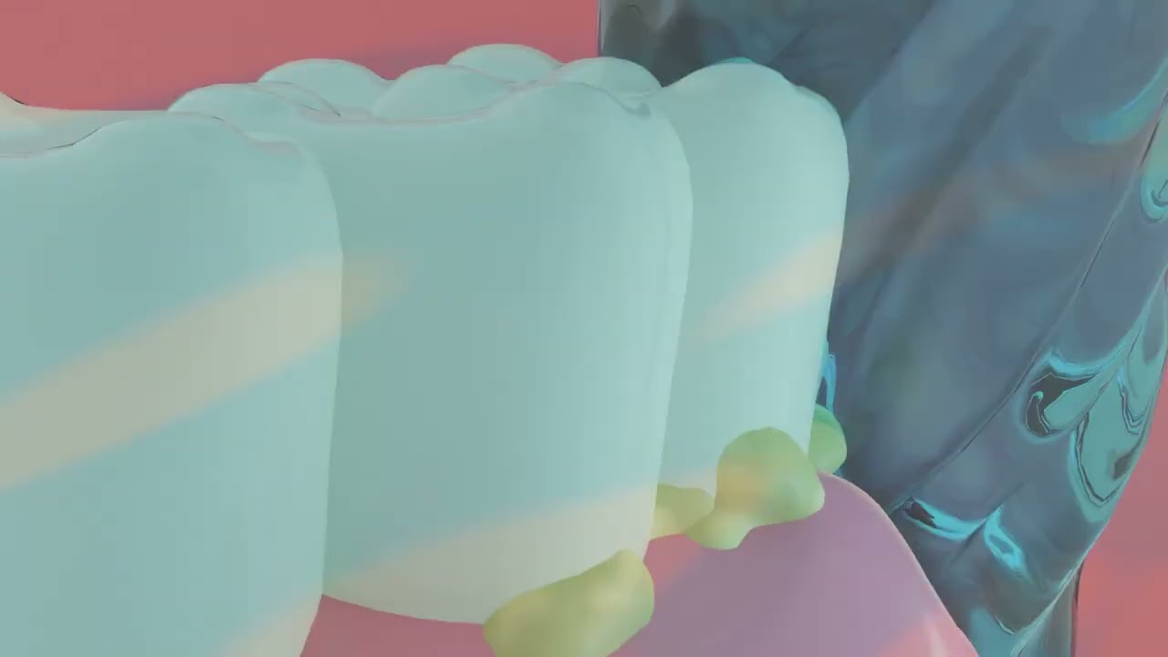 ろん、広告