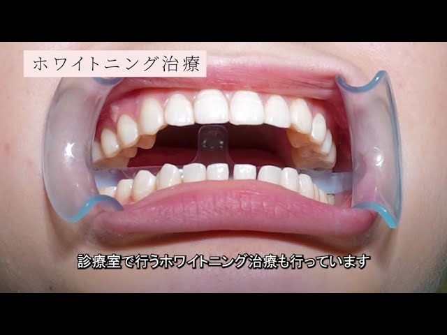 歯科医院オープニング動画