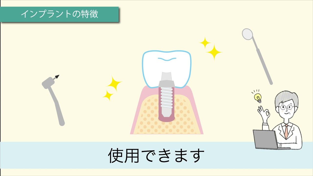 インプラント 解説動画 見本 BGM有